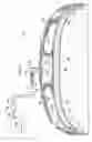 Fig. 02 - Abdominal treatment systems, delivery devices, and methods