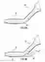 Fig. 07 - Articulating suturing device and method