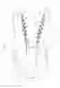 Fig. 02 - SURGICAL NEEDLE DRIVER AND METHOD OF MAKING THE SAME