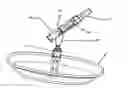 Fig. 01 - Occlusion Device And Surgical Instrument And Method For Its Implantation/Explantation