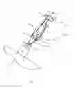 Fig. 06 - Occlusion Device And Surgical Instrument And Method For Its Implantation/Explantation