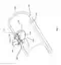 Fig. 02 - Closure system and uses thereof