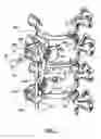 Fig. 07 - Bone fixation apparatus