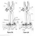 Fig. 06 - Compression plate kit and methods for repairing bone discontinuities
