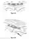 Fig. 07 - Compression plate kit and methods for repairing bone discontinuities