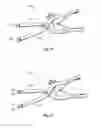 Fig. 09 - Compression plate kit and methods for repairing bone discontinuities