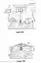 Fig. 09 - Odontoid fracture dynamic compression apparatus and method
