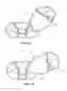 Fig. 09 - Implantation tools for interspinous process spacing device