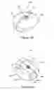 Fig. 22 - Implantation tools for interspinous process spacing device