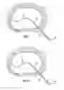 Fig. 06 - Device and method for treatment or evacuation of intervertebral disc or vertebral body