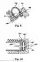 Fig. 09 - SHOCK ABSORBING APPARATUS AND METHOD