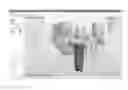 Fig. 01 - Tools for customized design of dental restorations