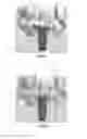 Fig. 03 - Tools for customized design of dental restorations