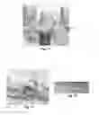 Fig. 06 - Tools for customized design of dental restorations