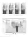 Fig. 07 - Tools for customized design of dental restorations