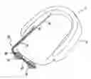 Fig. 01 - Devices, systems and methods for the treatment of sleep apnea