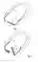 Fig. 02 - Devices, systems and methods for the treatment of sleep apnea
