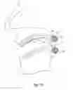 Fig. 22 - Devices, systems and methods for the treatment of sleep apnea