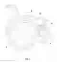 Fig. 02 - Wheelchair safety device