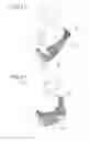 Fig. 08 - BABY SLING
