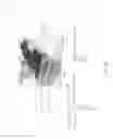 Fig. 45 - Antenna structures