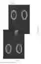 Fig. 46 - PRINTHEAD WITH BUBBLE VENTS