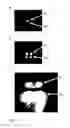 Fig. 02 - METHOD FOR DETECTING VEHICLE LIGHTS AND RETROREFLECTORS WITH A CAMERA SYSTEM