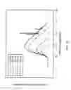 Fig. 07 - Orthovoltage radiosurgery