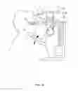 Fig. 11 - Orthovoltage radiosurgery