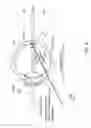 Fig. 19 - Orthovoltage radiosurgery