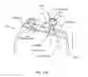 Fig. 37 - Orthovoltage radiosurgery