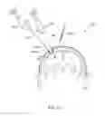 Fig. 48 - Orthovoltage radiosurgery