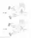 Fig. 49 - Orthovoltage radiosurgery