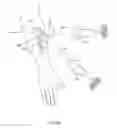 Fig. 53 - Orthovoltage radiosurgery