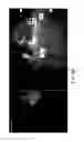 Fig. 06 - Automatic detection and quantification of plaque in the coronary arteries of subjects from CT scans