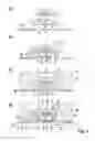 Fig. 02 - Microfluidic system for purposes of analysis and diagnosis and corresponding method for producing a microfluidic system