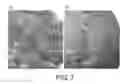 Fig. 08 - Method of treating amykloidosis comprising administering an anti-HMGB-1 antibody