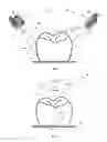 Fig. 02 - METHOD AND DEVICE FOR THREE-DIMENSIONAL MEASUREMENT OF A DENTAL MODEL