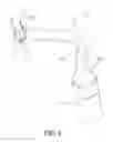 Fig. 06 - Ultrasonic sinus membrane/periosteum separation tool set