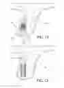 Fig. 12 - Ultrasonic sinus membrane/periosteum separation tool set