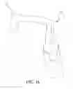 Fig. 15 - Ultrasonic sinus membrane/periosteum separation tool set