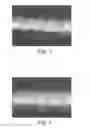 Fig. 02 - Dental Retraction Device and Process of its Production