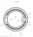 Fig. 12 - DENTAL COPING AND ASSEMBLY WITH ALIGNING ANTI-ROTATION FEATURE
