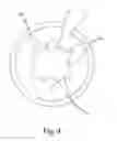Fig. 05 - SCREW FOR TOOTH IMPLANTING