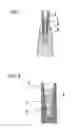 Fig. 02 - DENTAL PROSTHESIS
