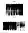 Fig. 08 - ENZYME-PORE CONSTRUCTS