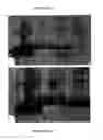 Fig. 02 - HUMAN CONSENSUS SODIUM-IODIDE SYMPORTER REPRESSOR (NIS-REPRESSOR) BINDING SITE
