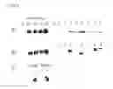 Fig. 07 - METHOD FOR DIAGNOSING POLYCYSTIC KIDNEY DISEASE