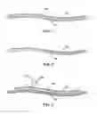 Fig. 02 - Laundry stain and soil pretreatment sheet