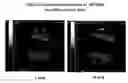 Fig. 01 - OSTEOGENESIS PROMOTER COMPRISING [4-(METHYLTHIO)PHENYLTHIO]METHANEBISPHOSPHONIC ACID OR PHARMACEUTICALLY ACCEPTABLE SALT THEREOF AS ACTIVE INGREDIENT